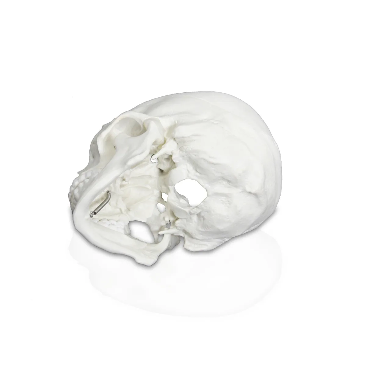 Life-Size Human Skull - Image 4