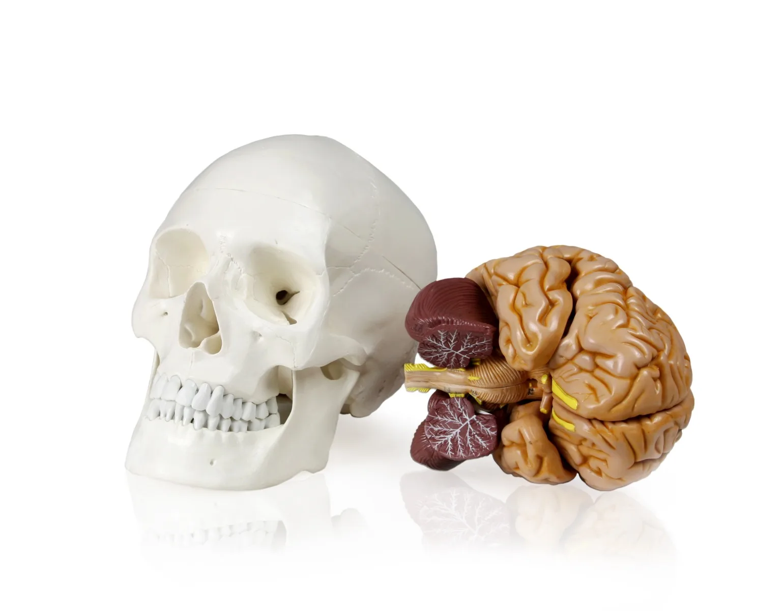 Human Skull with Brain - Image 2