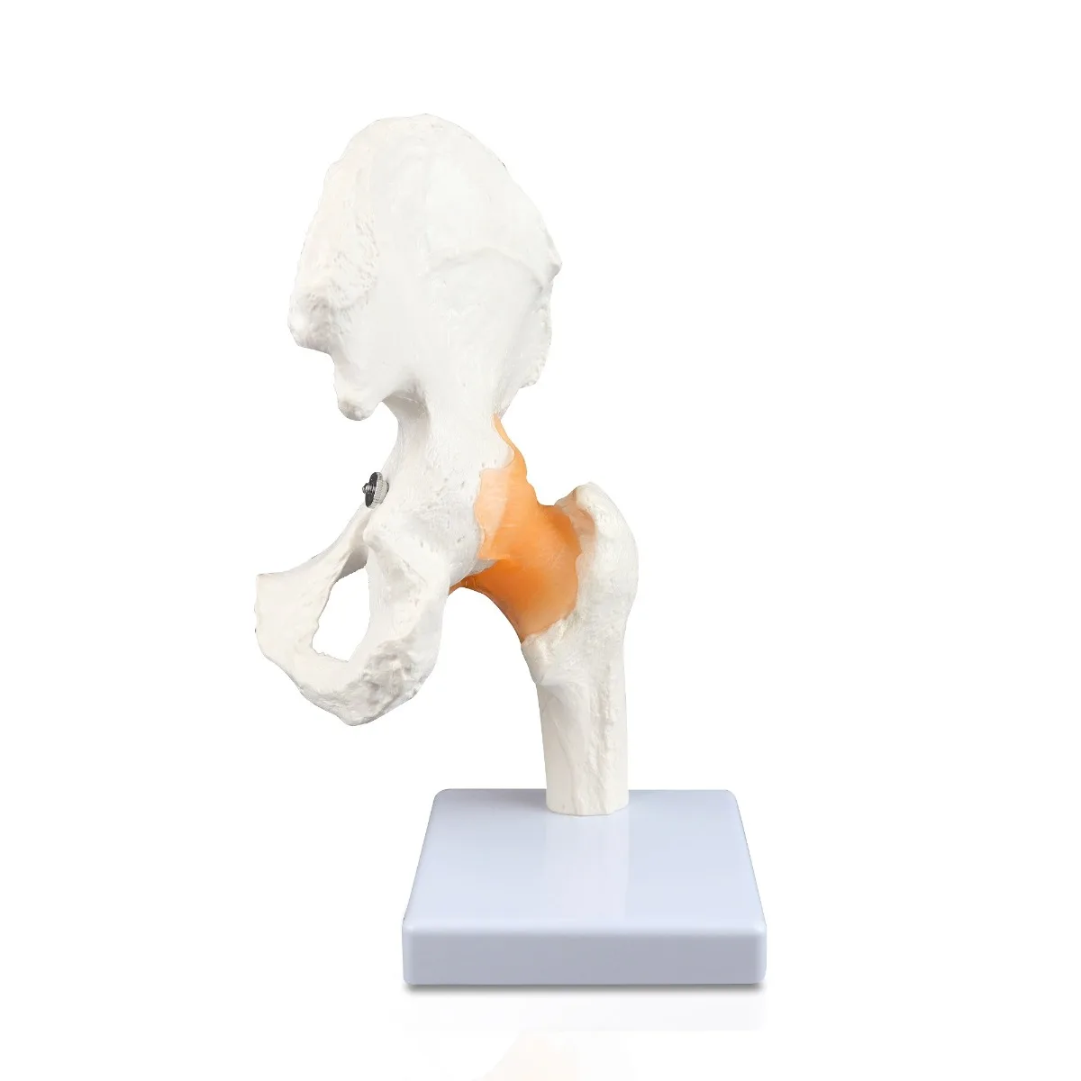 Hip Joint - Image 2