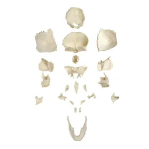 Disarticulated Human Skull