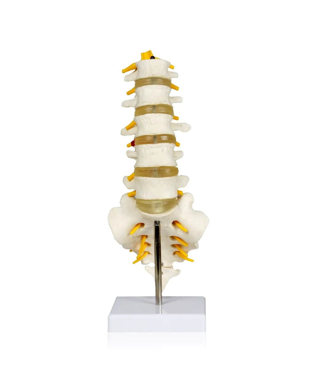 Lumbar Spinal Column - Image 2